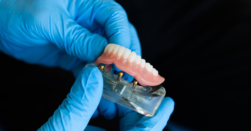 Dentures & Partial Dentures