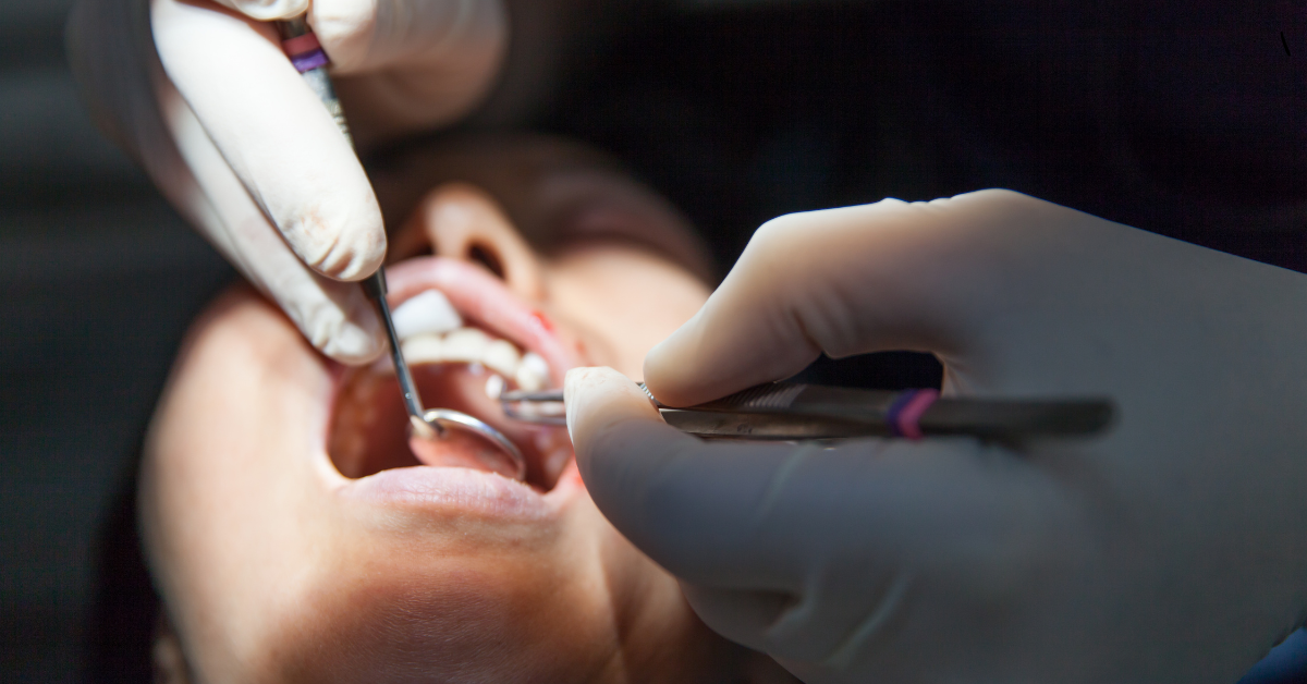 Oral Surgery in Marlton