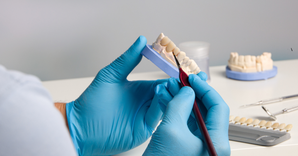 implant crowns and restorations